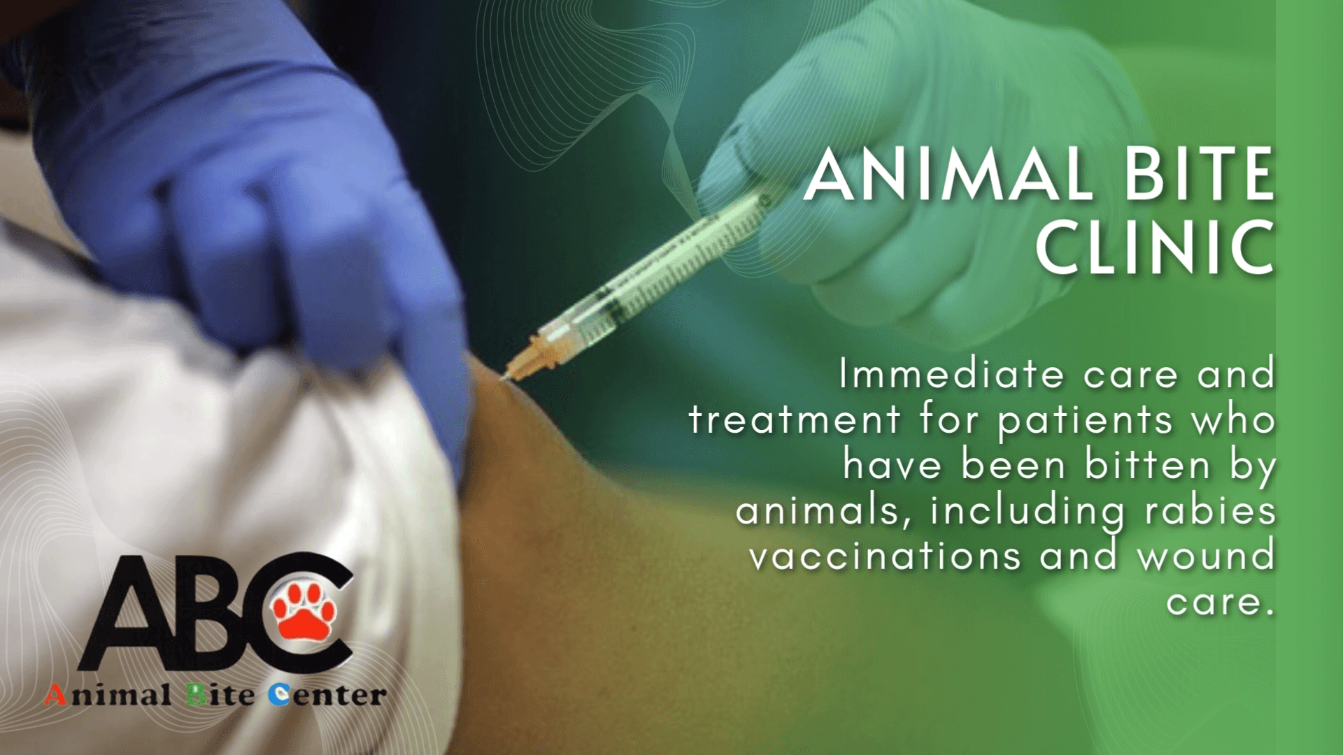 Animal Bite Center